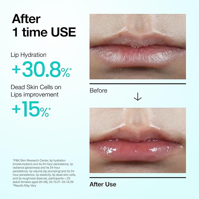 Anua - PDRN Lip Serum (x120) (Bulk Box)